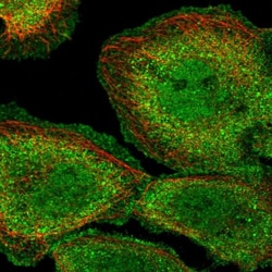PP1 alpha/PPP1A Antibody, Novus Biologicals 0.1mL; Unlabeled:Antibodies,